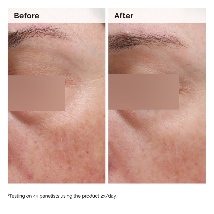niacinamide-5-face-and-body-emulsion-s2 2024-08-23-ORD-Nia-5pct-Face-Body-B-A-Elasticity-Global-02-1x1.jpg