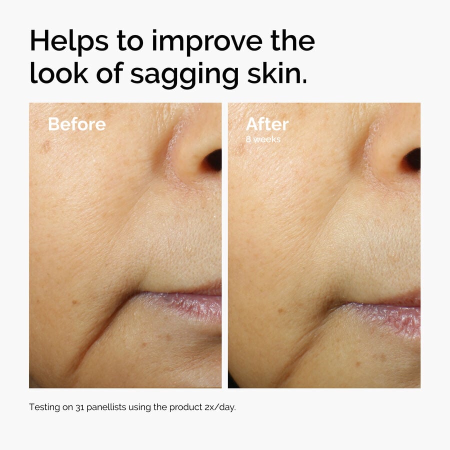 caffeine-3-escin-1-face-serum-d8 ord-caffeine-3pct-escin-1pct-face-serum-before-after-sagging.jpg