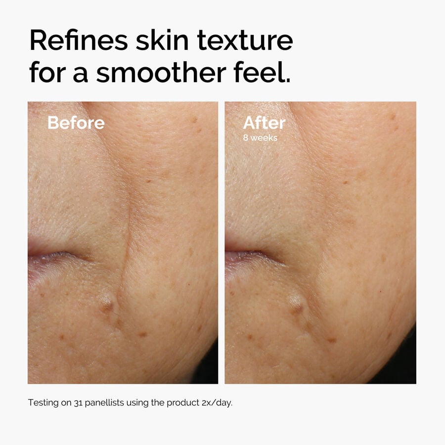 caffeine-3-escin-1-face-serum-d8 ord-caffeine-3pct-escin-1pct-face-serum-before-after-texture.jpg
