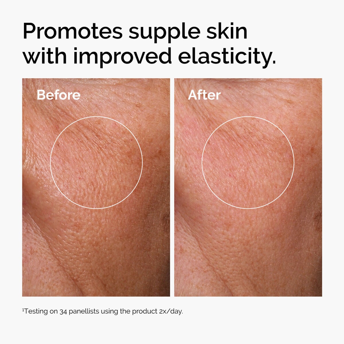 hyaluronic-acid-2-b5-with-ceramides-t9 ord-hyaluronic-acid-2pct-b5-hydrating-serum-before-after-elasticity.jpg