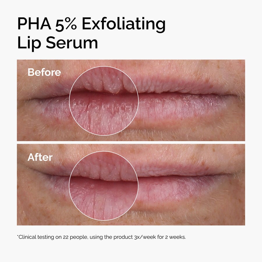 pha-5-exfoliating-lip-serum-t0 ord-pha-5pct-lip-exfoliating-serum-before-after.jpg