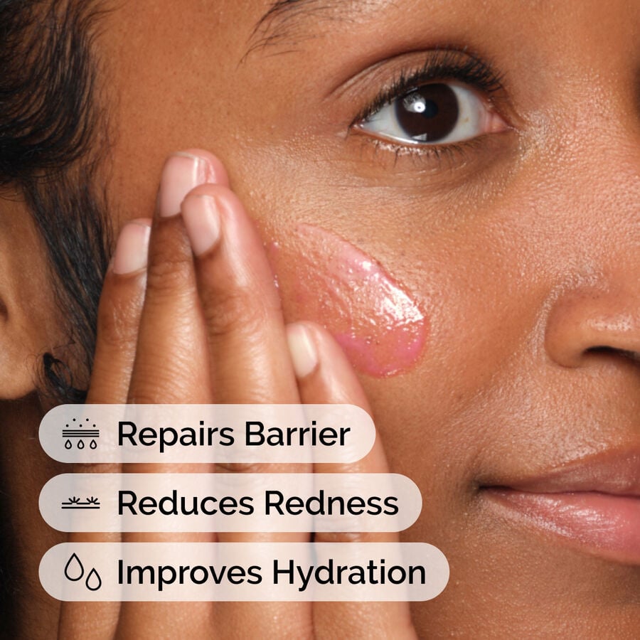 soothing-and-barrier-support-serum-set-b7 ord-soothing-barrier-support-serum-model-application-with-benefits.jpg