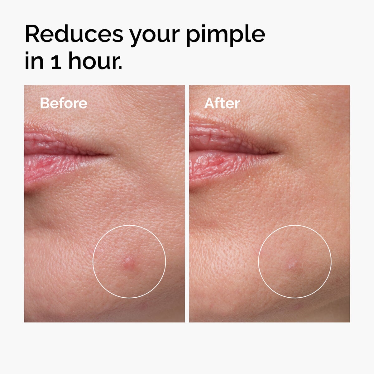 sulfur-10-powder-to-cream-concentrate-b4 ord-sulfur-10pct-powder-to-cream-concentrate-before-after-NA.jpg